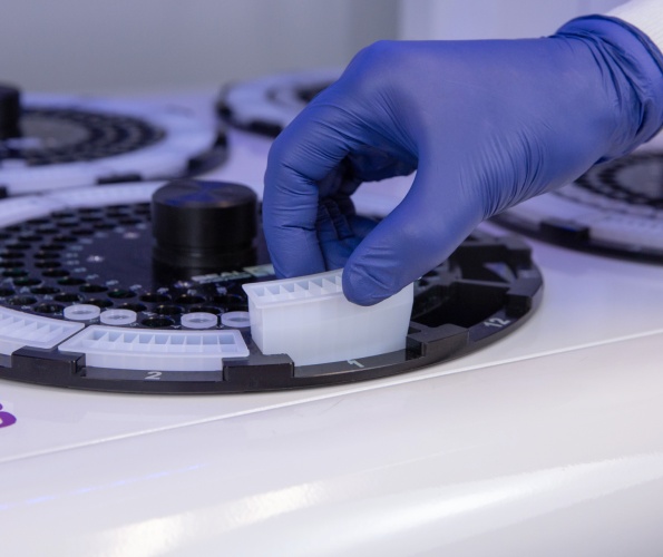 Lage verbruikskosten